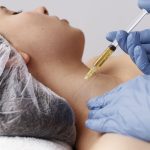 side-view-woman-getting-neck-prp-treatment