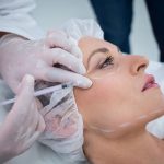 woman-with-marked-face-receiving-botox-injection